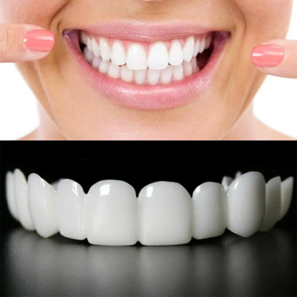 Snap-On Smile – Instant Smile Enhancement Teeth Veneers | Natural-Look Cosmetic Dental Cover